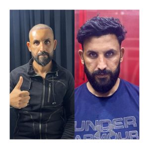 Before after result